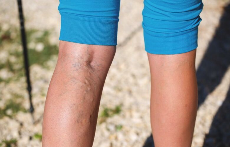 Uszkodzenie kończyn dolnych