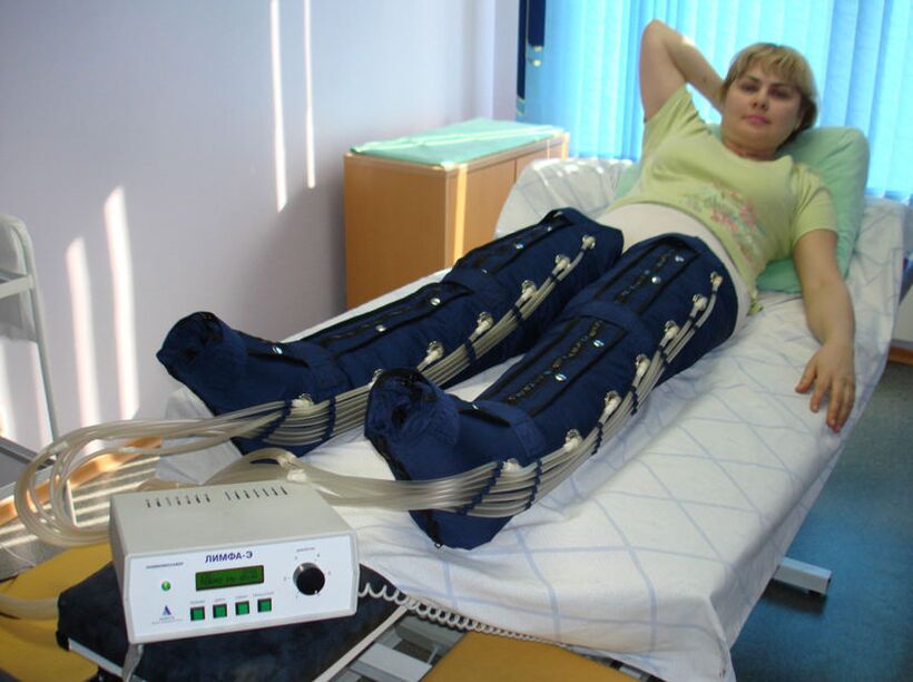 Presoterapia w leczeniu żylaków nóg