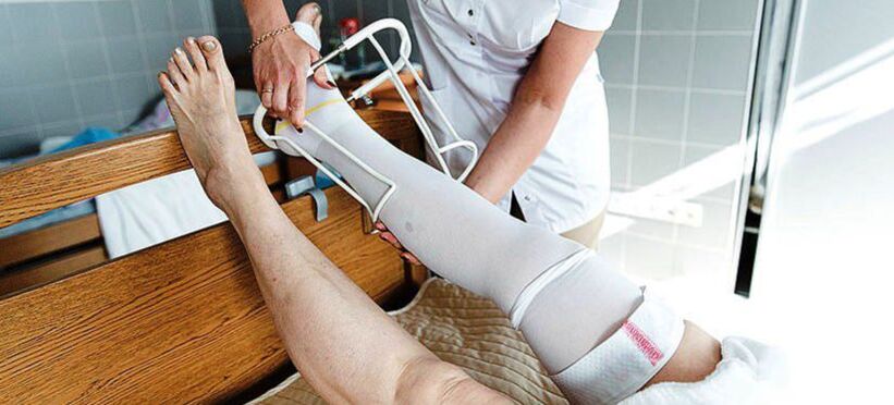 Wyroby uciskowe do leczenia żylaków